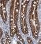 Cadherin 17 antibody, NBP1-88238, Novus Biologicals, Immunohistochemistry frozen image 