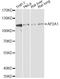 Adaptor Related Protein Complex 2 Subunit Alpha 1 antibody, STJ28943, St John