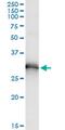 Homeobox protein Hox-B9 antibody, MA5-19117, Invitrogen Antibodies, Immunoprecipitation image 