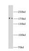 DLC1 Rho GTPase Activating Protein antibody, FNab02405, FineTest, Western Blot image 