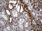 RAD21 Cohesin Complex Component antibody, M01864-1, Boster Biological Technology, Immunohistochemistry paraffin image 