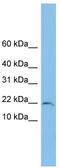 Trafficking Protein Particle Complex 1 antibody, TA344728, Origene, Western Blot image 