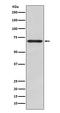 Glypican 3 antibody, M01922-1, Boster Biological Technology, Western Blot image 