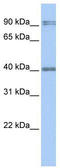 Absent In Melanoma 2 antibody, TA339684, Origene, Western Blot image 