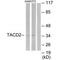 Tumor Associated Calcium Signal Transducer 2 antibody, PA5-49782, Invitrogen Antibodies, Western Blot image 
