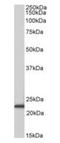 Achaete-Scute Family BHLH Transcription Factor 3 antibody, orb125133, Biorbyt, Western Blot image 