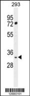 FSHD Region Gene 2 Family Member B antibody, 55-604, ProSci, Western Blot image 