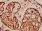 Histone Cluster 4 H4 antibody, A14495-1, Boster Biological Technology, Immunohistochemistry paraffin image 