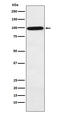 Complement Factor B antibody, M01260, Boster Biological Technology, Western Blot image 