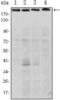 RPTOR Independent Companion Of MTOR Complex 2 antibody, GTX82786, GeneTex, Western Blot image 