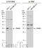 TNFRSF1A Associated Via Death Domain antibody, GTX113042, GeneTex, Western Blot image 