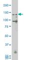 Mitogen-Activated Protein Kinase Kinase Kinase Kinase 4 antibody, H00009448-M07, Novus Biologicals, Western Blot image 