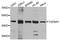 Transforming Growth Factor Beta Receptor 1 antibody, A0708, ABclonal Technology, Western Blot image 