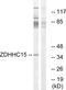 Zinc Finger DHHC-Type Containing 15 antibody, PA5-39327, Invitrogen Antibodies, Western Blot image 