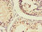 Interferon-inducible protein AIM2 antibody, LS-C498354, Lifespan Biosciences, Immunohistochemistry frozen image 