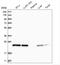 RAB3 GTPase Activating Non-Catalytic Protein Subunit 2 antibody, NBP1-84199, Novus Biologicals, Western Blot image 