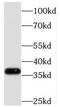 Mitochondrial Trans-2-Enoyl-CoA Reductase antibody, FNab05085, FineTest, Western Blot image 