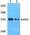Ras Association (RalGDS/AF-6) And Pleckstrin Homology Domains 1 antibody, PA5-37203, Invitrogen Antibodies, Western Blot image 