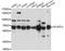 Acyl-CoA Dehydrogenase Very Long Chain antibody, STJ110175, St John