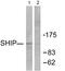 Inositol Polyphosphate-5-Phosphatase D antibody, LS-B11346, Lifespan Biosciences, Western Blot image 