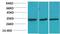 Calcium Voltage-Gated Channel Auxiliary Subunit Gamma 3 antibody, A13931, Boster Biological Technology, Western Blot image 