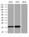 Anterior Gradient 2, Protein Disulphide Isomerase Family Member antibody, LS-C795128, Lifespan Biosciences, Western Blot image 