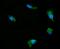 Dual Specificity Phosphatase 6 antibody, A02157-2, Boster Biological Technology, Immunofluorescence image 
