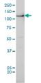 mBUB1 antibody, H00000699-M02, Novus Biologicals, Western Blot image 