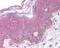BRCA1 Associated RING Domain 1 antibody, 49-656, ProSci, Immunohistochemistry frozen image 