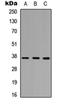 PIN2 (TERF1) Interacting Telomerase Inhibitor 1 antibody, orb256752, Biorbyt, Western Blot image 