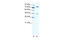 Zinc Finger Protein 225 antibody, 28-375, ProSci, Western Blot image 