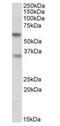 SIGLEC6 antibody, orb20620, Biorbyt, Western Blot image 