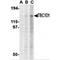 TBC1 Domain Family Member 1 antibody, MBS151090, MyBioSource, Western Blot image 