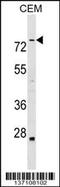 Actin Binding LIM Protein Family Member 3 antibody, 59-200, ProSci, Western Blot image 