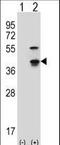 Cyclin Dependent Kinase 3 antibody, LS-C164333, Lifespan Biosciences, Western Blot image 