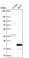 Zymogen Granule Protein 16 antibody, PA5-62629, Invitrogen Antibodies, Western Blot image 