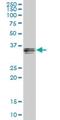 GIPC PDZ Domain Containing Family Member 1 antibody, H00010755-B01P, Novus Biologicals, Western Blot image 