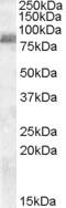 Zinc Finger RANBP2-Type Containing 1 antibody, orb19911, Biorbyt, Western Blot image 