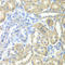 NADH:Ubiquinone Oxidoreductase Core Subunit V2 antibody, LS-C349141, Lifespan Biosciences, Immunohistochemistry frozen image 