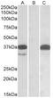 Pim-2 Proto-Oncogene, Serine/Threonine Kinase antibody, AP32854PU-N, Origene, Western Blot image 