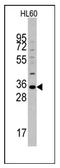 Diacylglycerol O-acyltransferase candidate 5 antibody, AP11156PU-N, Origene, Western Blot image 