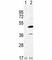 Interleukin 1 Receptor Associated Kinase 4 antibody, F53765-0.4ML, NSJ Bioreagents, Western Blot image 