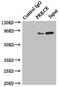 Protein Kinase C Epsilon antibody, LS-C376413, Lifespan Biosciences, Immunoprecipitation image 