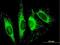 Translocase Of Outer Mitochondrial Membrane 70 antibody, H00009868-B01P, Novus Biologicals, Immunofluorescence image 