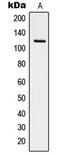 Protein Tyrosine Kinase 2 antibody, GTX32252, GeneTex, Western Blot image 