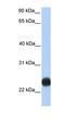 Transmembrane Protein 123 antibody, orb330609, Biorbyt, Western Blot image 