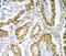 Protein Arginine Methyltransferase 1 antibody, A01417-3, Boster Biological Technology, Immunohistochemistry frozen image 