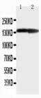 Collagen Type II Alpha 1 Chain antibody, PA5-79057, Invitrogen Antibodies, Western Blot image 