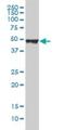 Keratin 20 antibody, H00054474-M01, Novus Biologicals, Western Blot image 