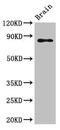 GIT ArfGAP 1 antibody, CSB-PA009439LA01HU, Cusabio, Western Blot image 
